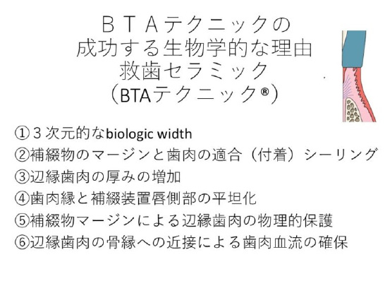 ＢＴＡテクニック