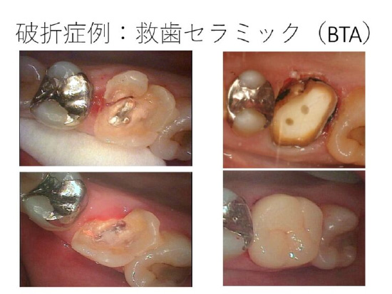 ＢＴＡテクニック