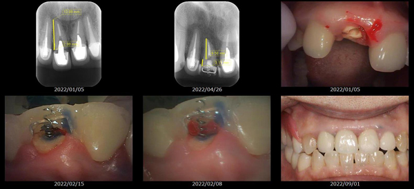 MTMを使用した治療画像