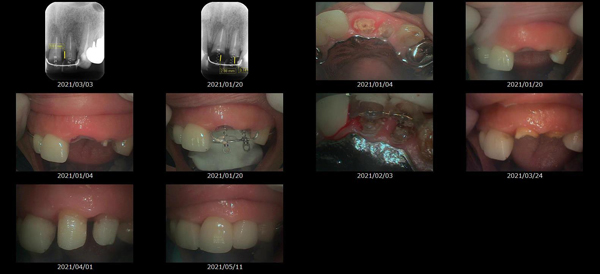 MTMを使用した治療画像