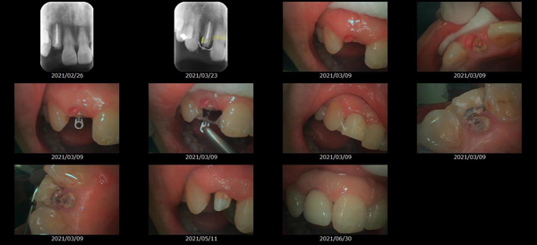 MTMを使用した治療画像