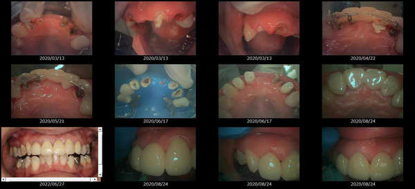MTMを使用した治療画像