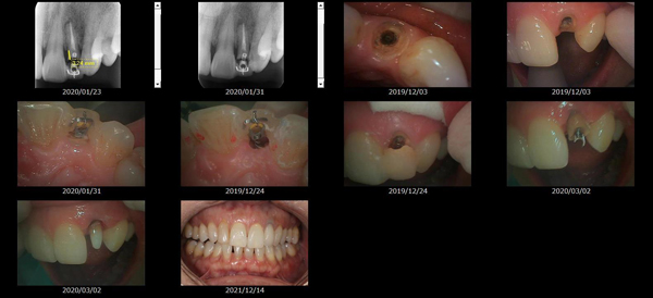 MTMを使用した治療画像