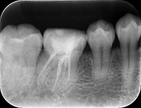 レントゲン画像