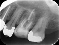 レントゲン画像