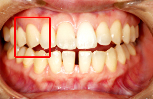 サージテルがもたらす“別世界”に何があるのか1