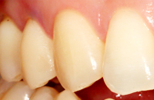 サージテルがもたらす“別世界”に何があるのか2