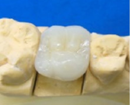 ハイブリッドセラミック