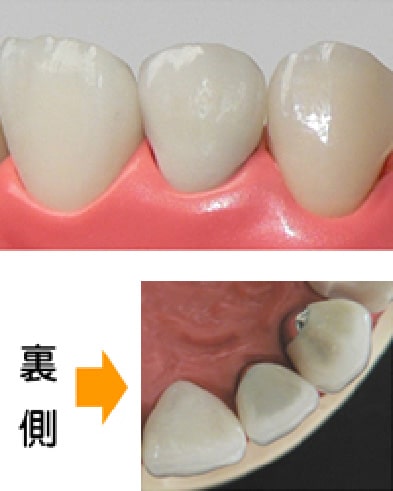 ハイブリッドセラミック