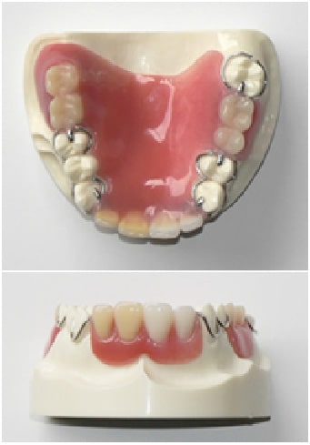 プラスチック義歯