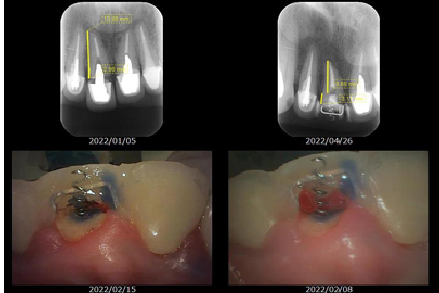 得意分野（救歯）